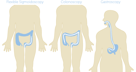 GI Endoscopy